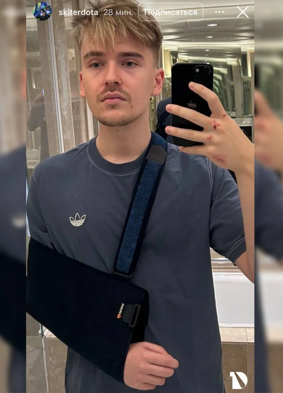 Оливер Skiter Лепко