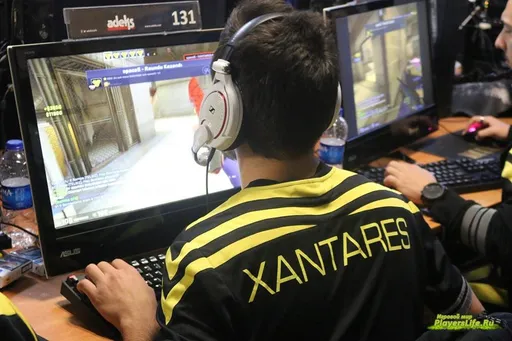 XANTARES сделали операцию по уменьшению потливости ладоней