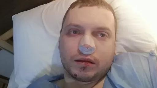 Тульские СМИ начали постить новость о Папиче, который упал в открытый люк